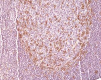 REV_immunooncology_antibody