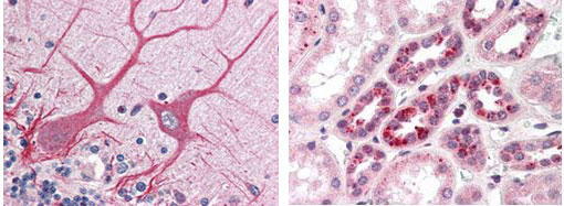 Notch Signaling pXEFCR̂̎gp