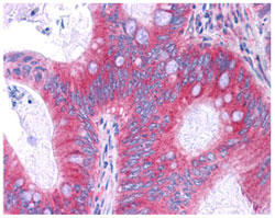 p65 サブユニットの免疫組織染色