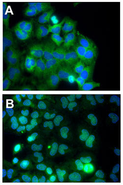 anti NF-κB p65 (Rel A) antibodyを用いて免疫蛍光染色でp65細胞を検出