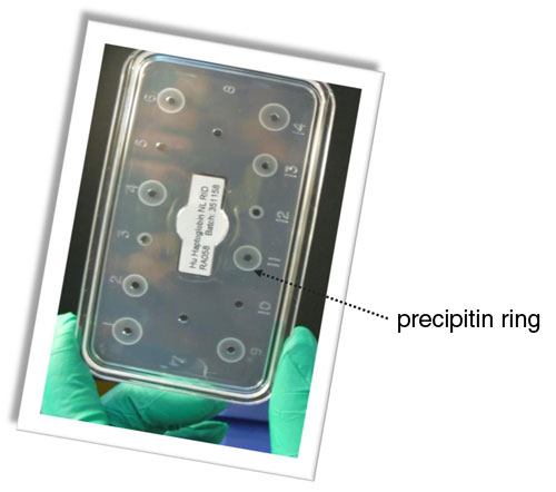 precipitin ring