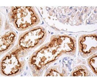 ヒト肝臓パラフィン包埋組織の免疫組織染色図