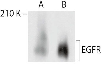 HEK293T細胞におけるヒトEGFR遺伝子の活性化