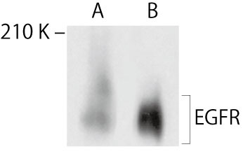 CRISPR/Cas9 SAM ]ʊVXegpf[^