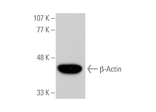 β-Actinの検出