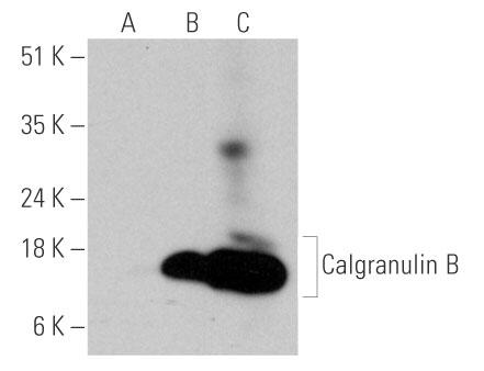 Calgranulin Bの検出