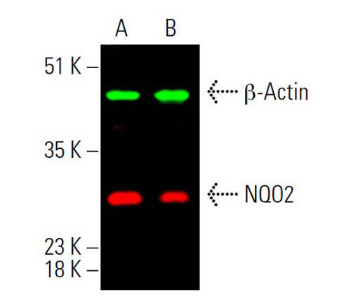 β-Actin（緑）、NQO2（赤）