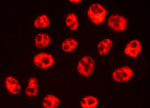 HeLa細胞でのhnRNPの検出