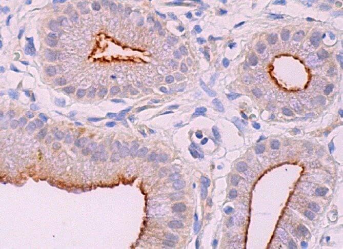 本抗体を用いたヒト胆嚢組織（ホルマリン固定パラフィン包埋）の免疫ペルオキシダーゼ染色