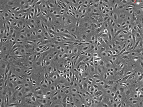 扁桃内皮細胞（HTEC）