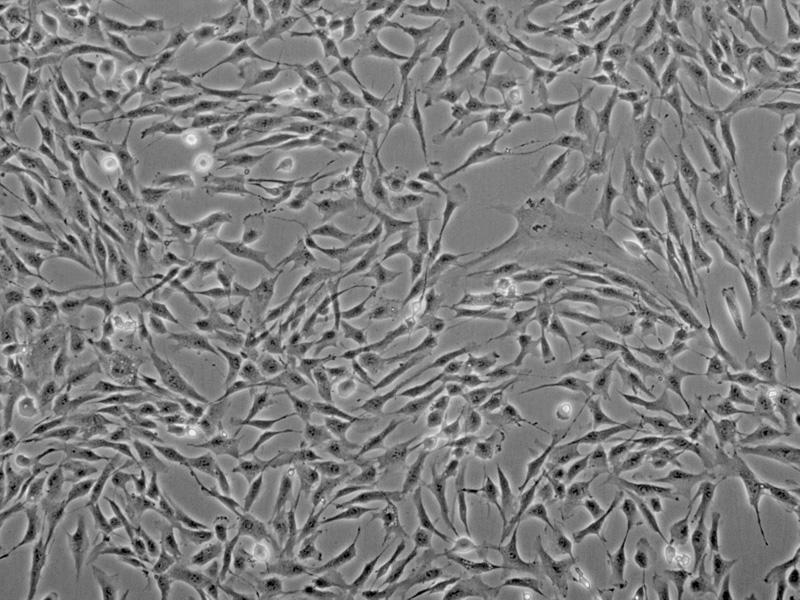 扁桃腺線維芽細胞