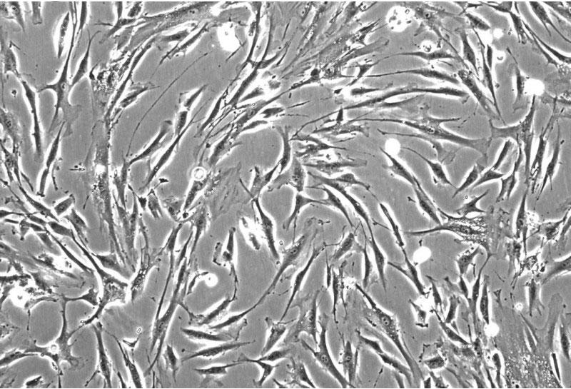 ヒト歯根膜線維芽細胞 (HPLF) 位相差顕微鏡画像　200×