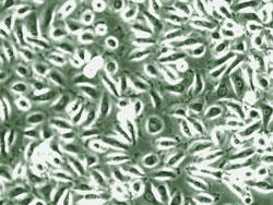 ヒト食道上皮細胞 (品番2700) の位相差顕微鏡画像