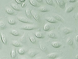 ヒト食道上皮細胞 (品番2700) のレリーフ画像