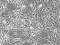 培養したヒト滑膜細胞（品番4700）（継代数1）の位相差顕微鏡画像