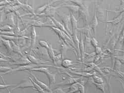 培養したヒト滑膜細胞（品番4700）（継代数1）のレリーフ画像