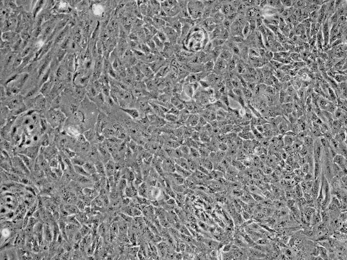 ヒト肝細胞（HH） 位相差顕微鏡画像　100×