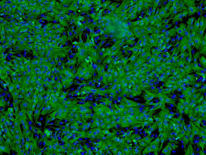 ヒト肝静脈内皮細胞（HHSEC） ファクターVIIIの免疫蛍光染色　100×