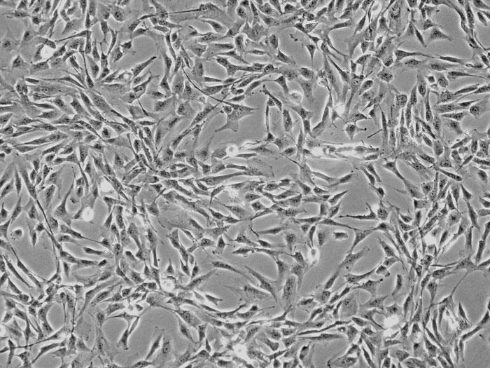 ヒト肝星状細胞 (HHSteC) 位相差顕微鏡画像　100×