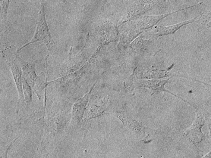 ヒト肝星状細胞 (HHSteC) レリーフコントラスト画像　400×