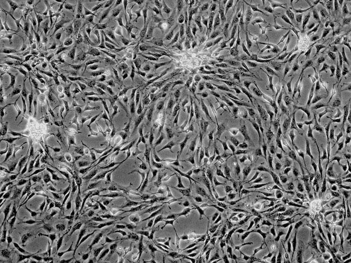 培養したヒト心筋細胞 (品番6200)。細胞集塊もしくは丘状構造（図の真ん中）が形成された。集塊の細胞は鼓動している