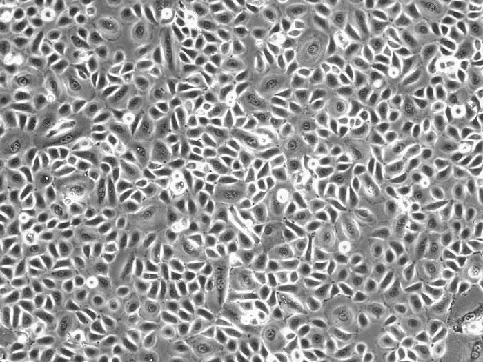 ヒト角膜上皮細胞 (HCEpiC) 位相差顕微鏡画像　100×