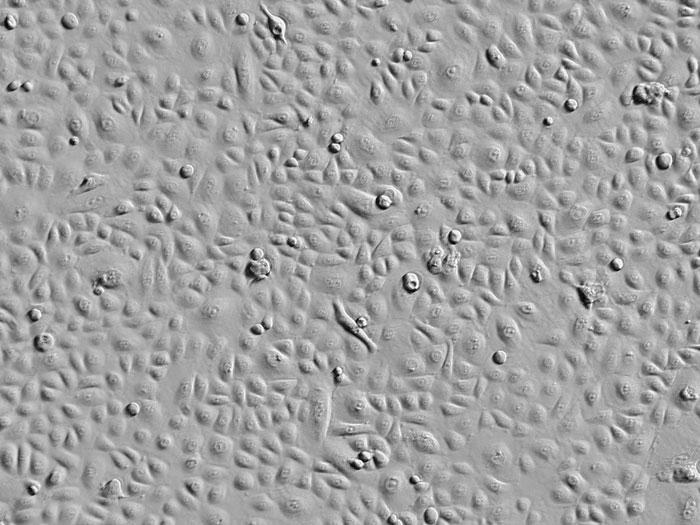 ヒト角膜上皮細胞 (HCEpiC) レリーフコントラスト画像　100×