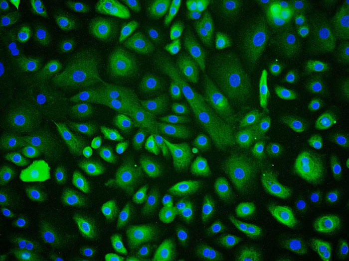 ヒト角膜上皮細胞 (HCEpiC) CK-18 抗体の免疫蛍光染色　200×