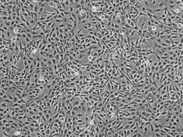 ヒト網膜色素上皮細胞（HRPEpiC） 位相差顕微鏡画像　100×