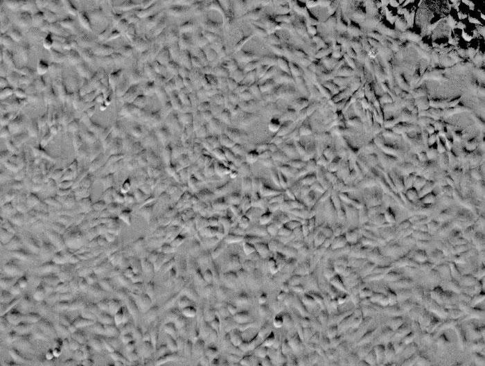 ヒト網膜色素上皮細胞（HRPEpiC） レリーフコントラスト画像　100×