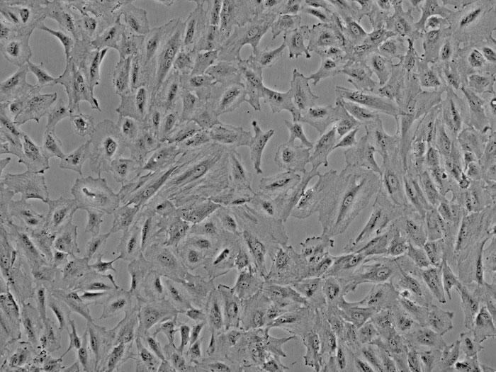 ヒト水晶体上皮細胞 (HLEpiC) 位相差顕微鏡画像　100×