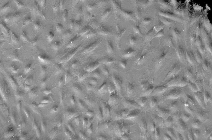 ヒト水晶体上皮細胞 (HLEpiC) レリーフコントラスト画像　100×
