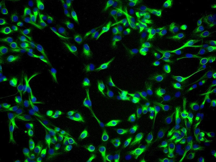 ヒト水晶体上皮細胞 (HLEpiC) CK-19 抗体の免疫蛍光染色　200×