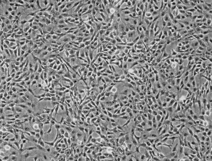 ヒト虹彩色素上皮細胞 (HIPEpiC) 位相差顕微鏡画像　100×