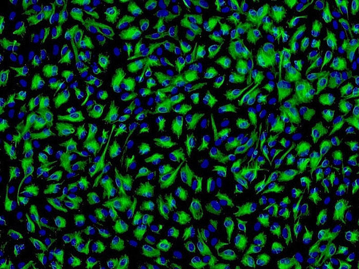 ヒト虹彩色素上皮細胞 (HIPEpiC) CK-18 抗体の免疫蛍光染色　200×