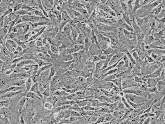 ヒト眼球脈絡膜線維芽細胞 (HOCF) 位相差顕微鏡画像　200×