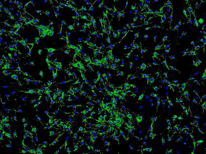 ヒト眼球脈絡膜線維芽細胞 (HOCF) フィブロネクチン抗体の免疫蛍光染色　100×