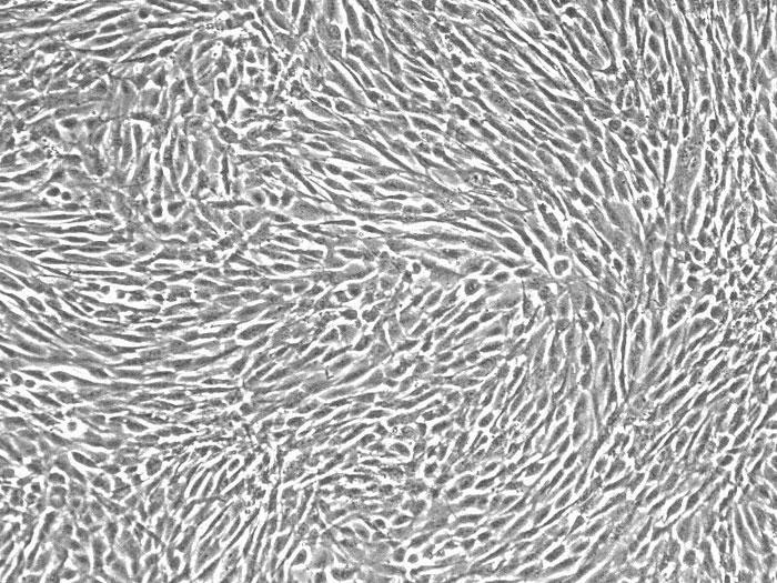 培養したヒト脂肪前駆細胞（品番7210）（継代数1）の位相差顕微鏡画像