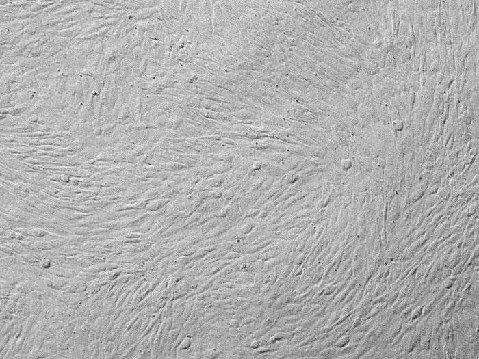 培養したヒト脂肪前駆細胞（品番7210）のレリーフ画像