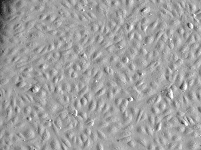 ヒト臍帯静脈内皮細胞 (HUVEC) 位相差顕微鏡画像　200×