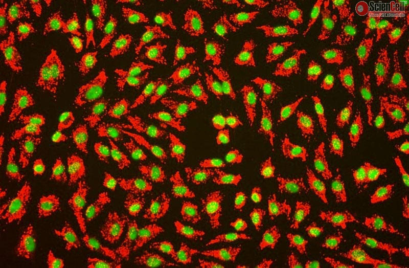 ヒト臍帯静脈内皮細胞 (HUVEC) 第VIII因子の免疫蛍光染色　200×