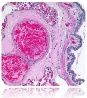 w}gLVEGIWFiHematoxylin-Eosin Stainj