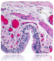 Hematoxylin, Mayer’s