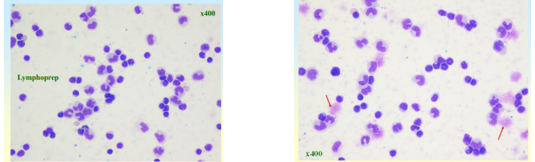 SEW_lymphoprep_03.png
