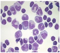 SEW_monocyte_app_02.png