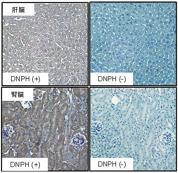 マウス肝臓（上段）、腎臓（下段）を100倍希釈ウサギ抗DNPポリクローナル抗体で免疫染色した。