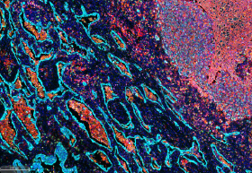 ULT_fixvue_multiplex_if_staining