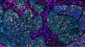 ULT_fixvue_multiplex_if_staining