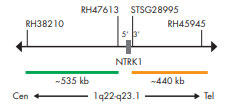 SPEC NTRK1 Probẽ}bv