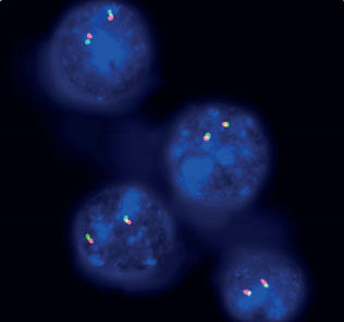 ZytoLight® SPEC CIC Dual Color Break Apart Probe | EWSR1陰性小青色